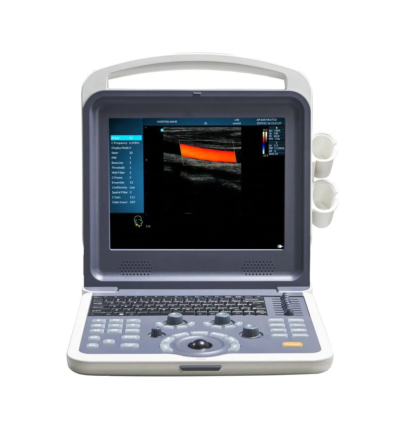 12” Colour Doppler Ultrasound Diagnostic System Human