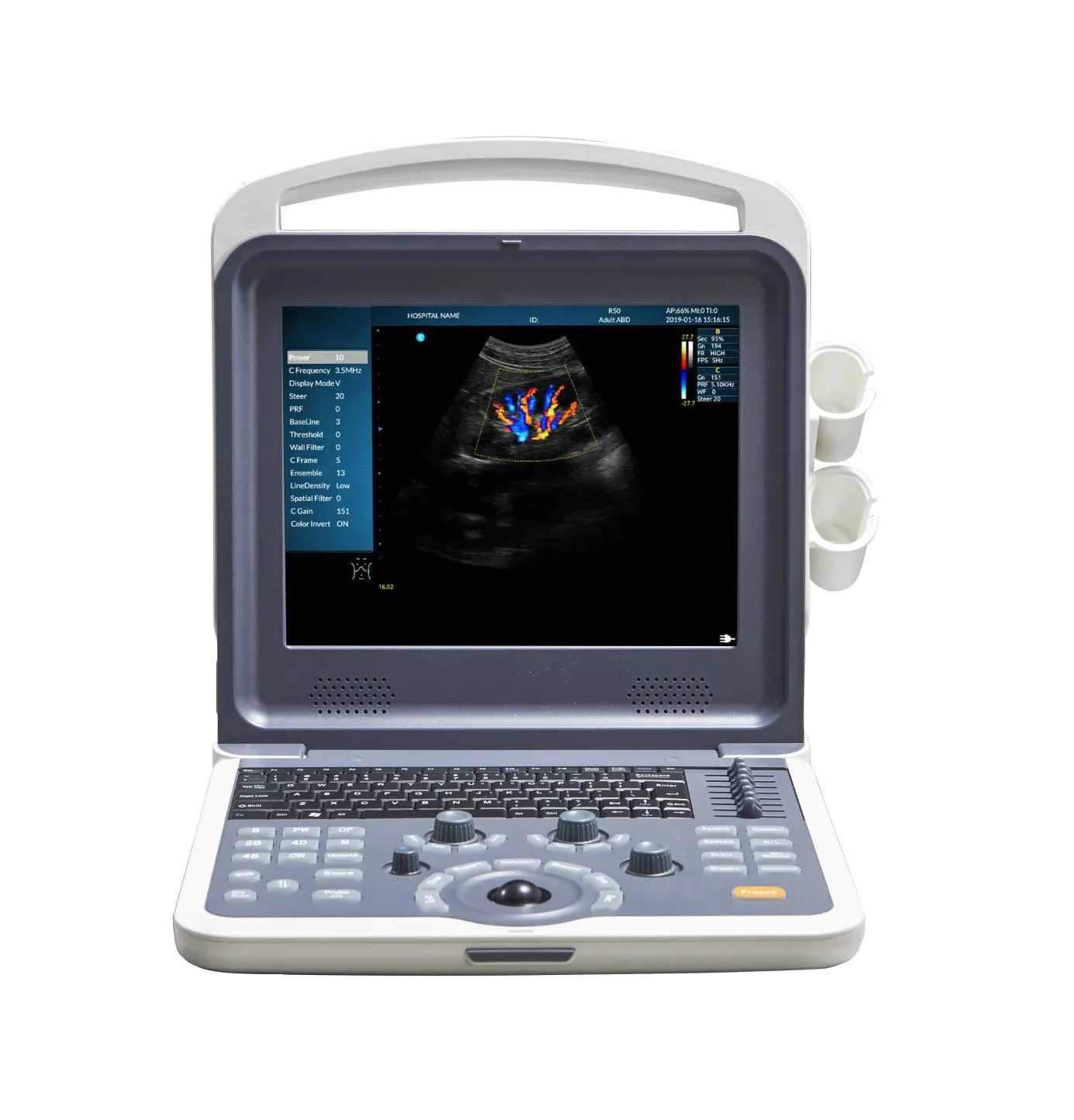 12” Colour Doppler Ultrasound Diagnostic System Human