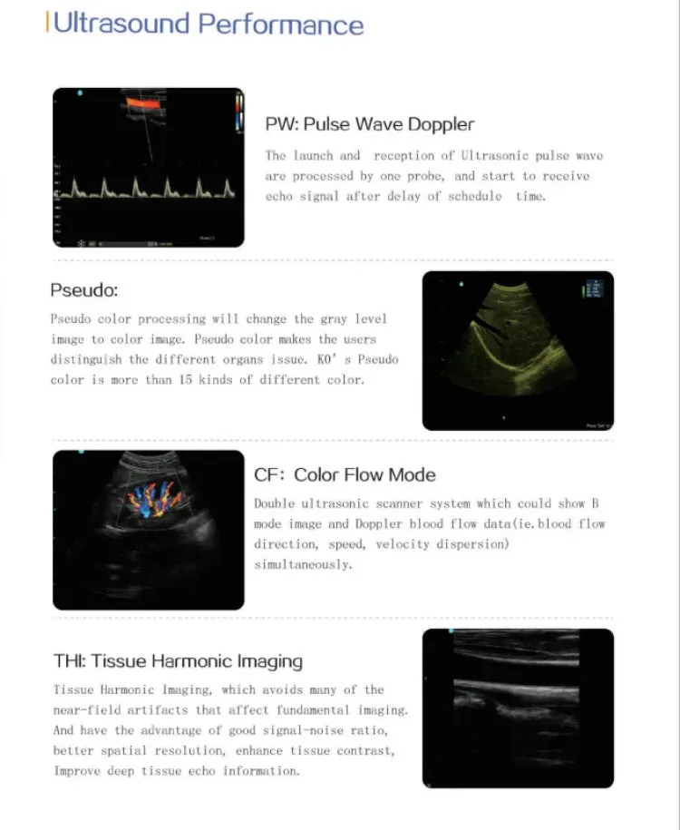 12” Colour Doppler Ultrasound Diagnostic System Human