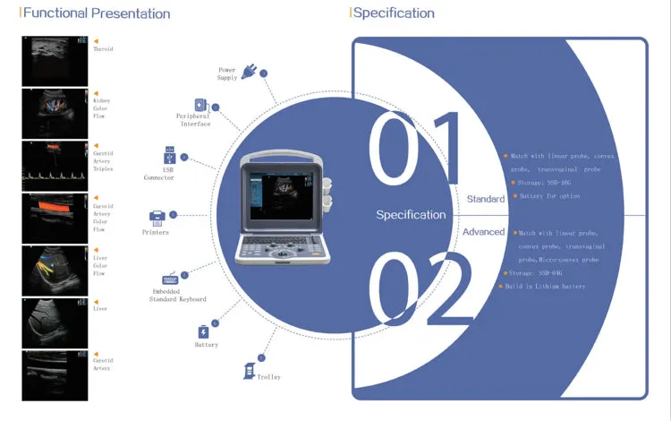 12” Colour Doppler Ultrasound Diagnostic System Human