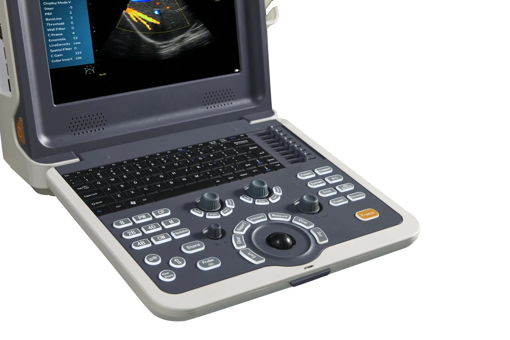 12” Colour Doppler Ultrasound Diagnostic System Human