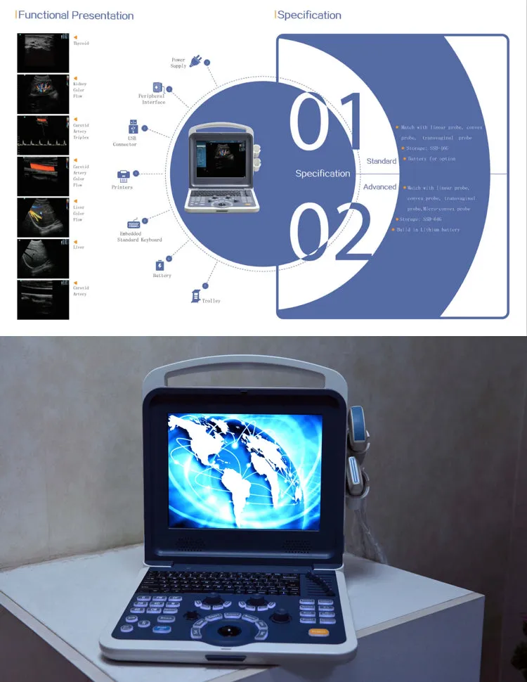 12” Colour Doppler Ultrasound Diagnostic System Human